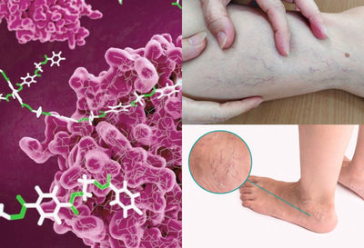 Serrapeptase Benefits for Varicose Veins