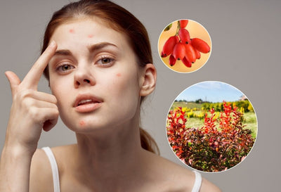 berberine for acne